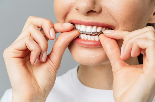 Orthodontists And Their Ways To Treat Patients With Invisalign | TheAmberPost