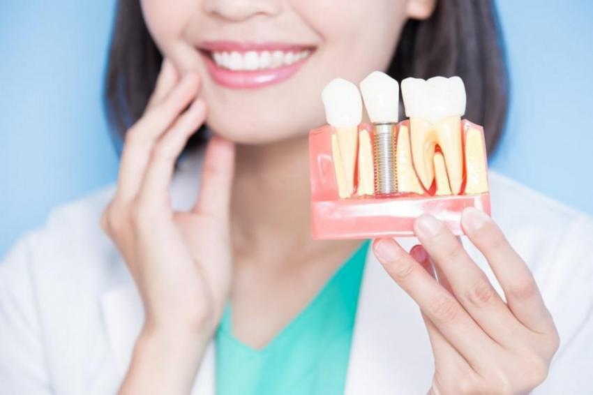 How Long Can You Wait For An All-On-4 Dental Implant After Extraction? | Flokii